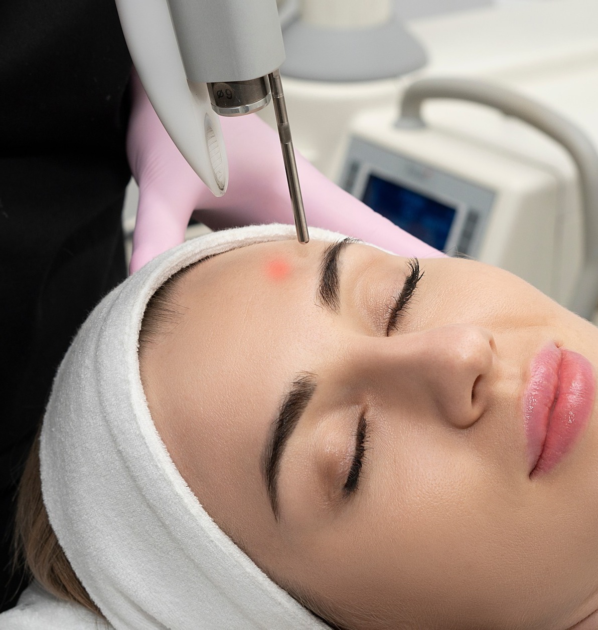 laser skin resurfacing christchurch moxi