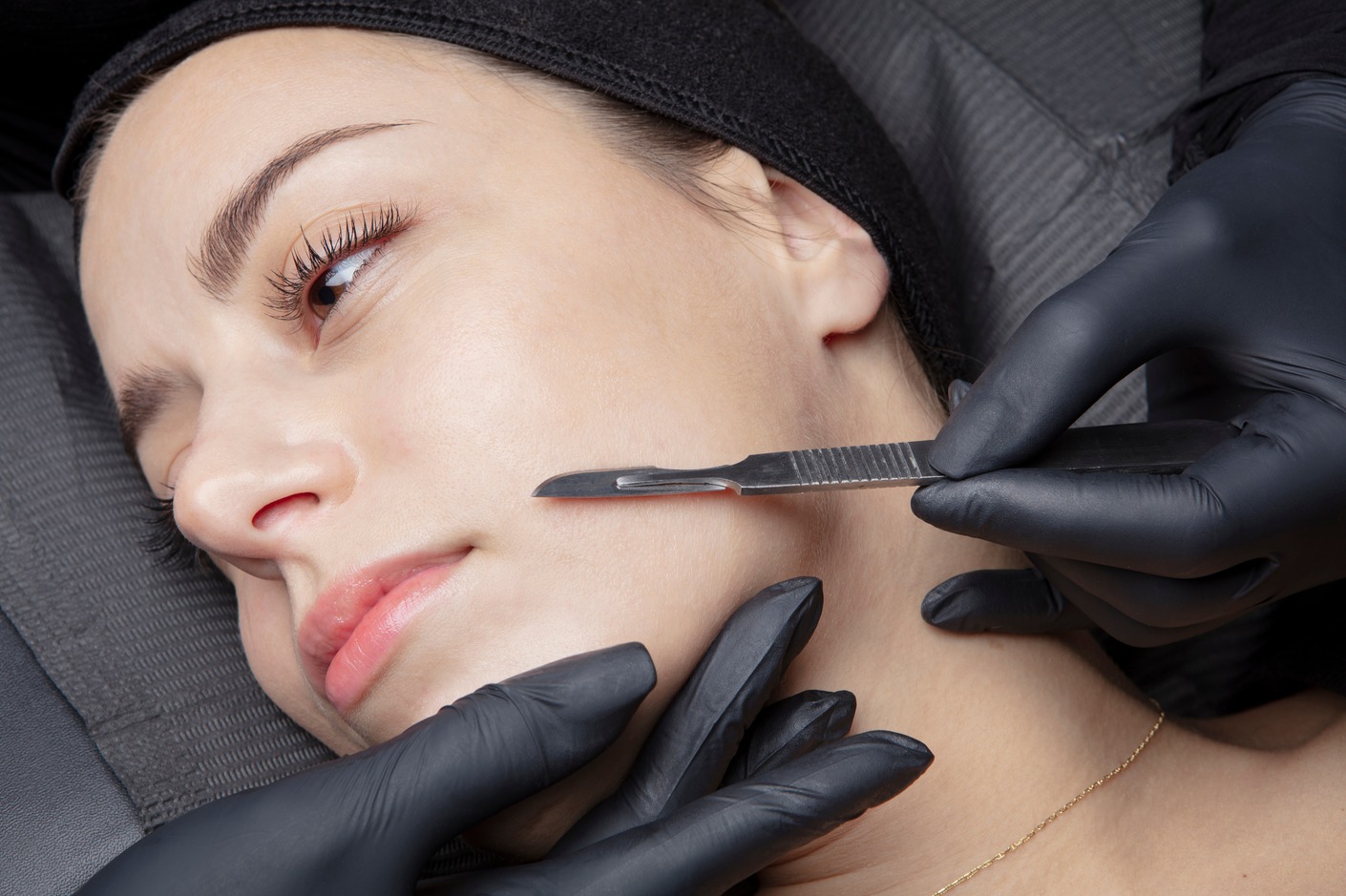 Dermaplaning treatment