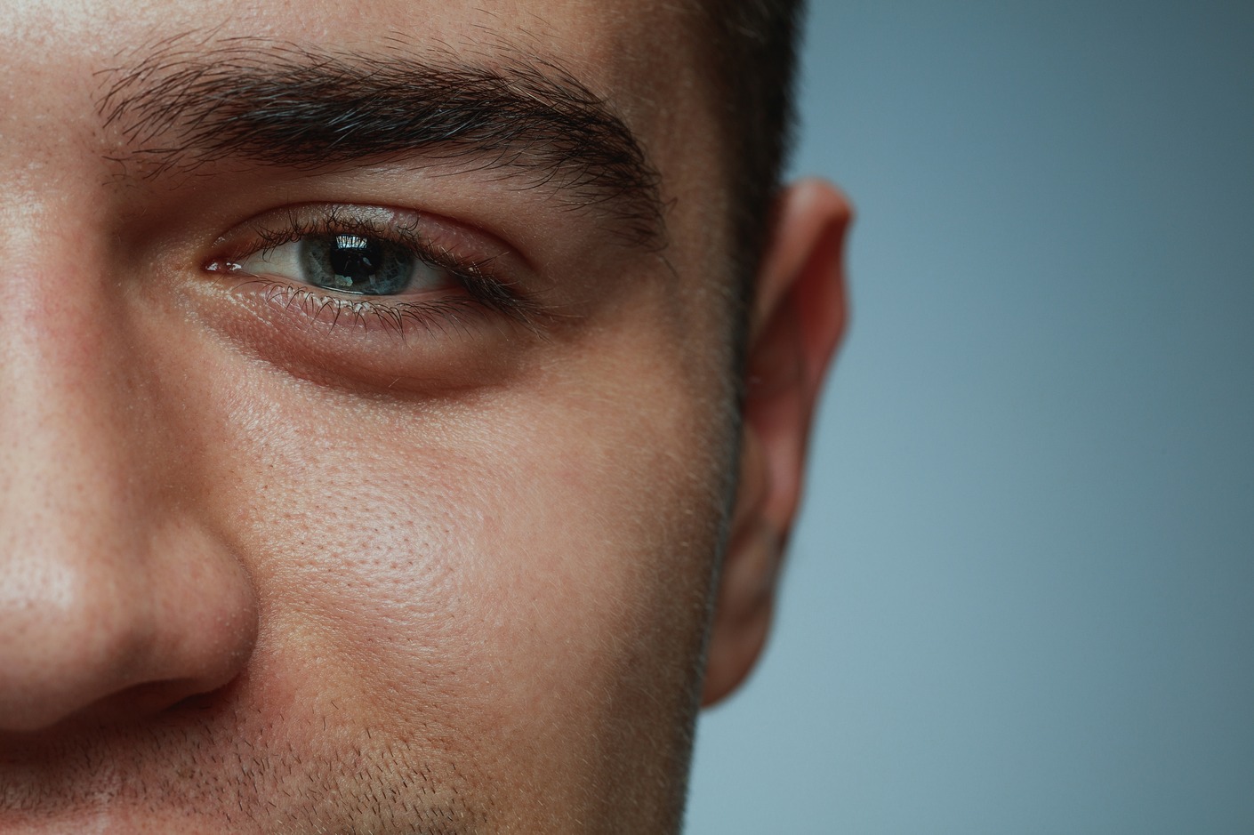 facial vein removal christchurch